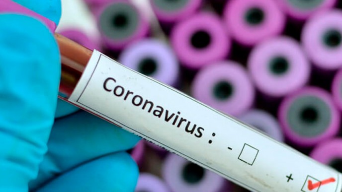 kuva koeputkesta jossa lukee coronavirus